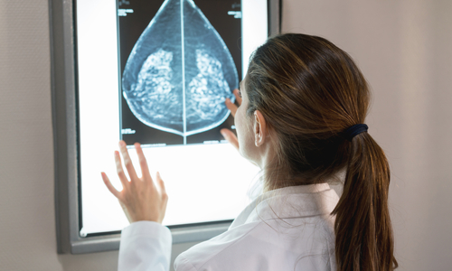 BreastImaging_GettyImages-917730078.jpg