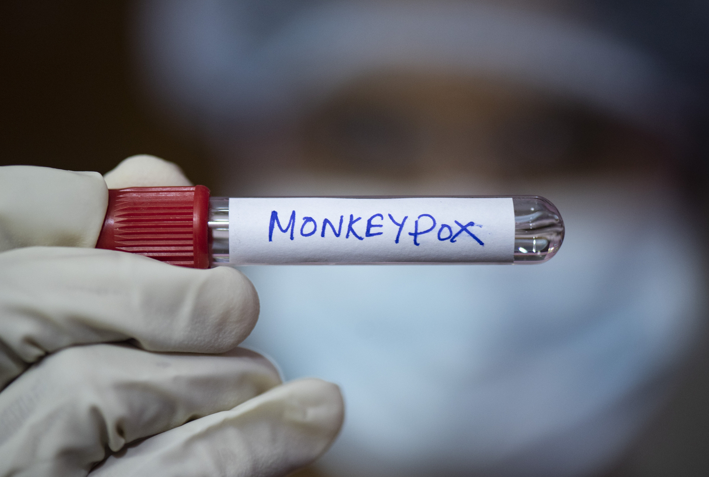 Monkeypox vial.jpg