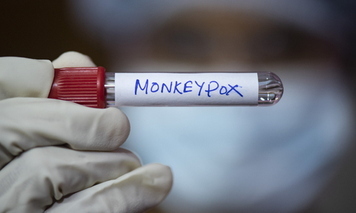 Monkeypox vial.jpg