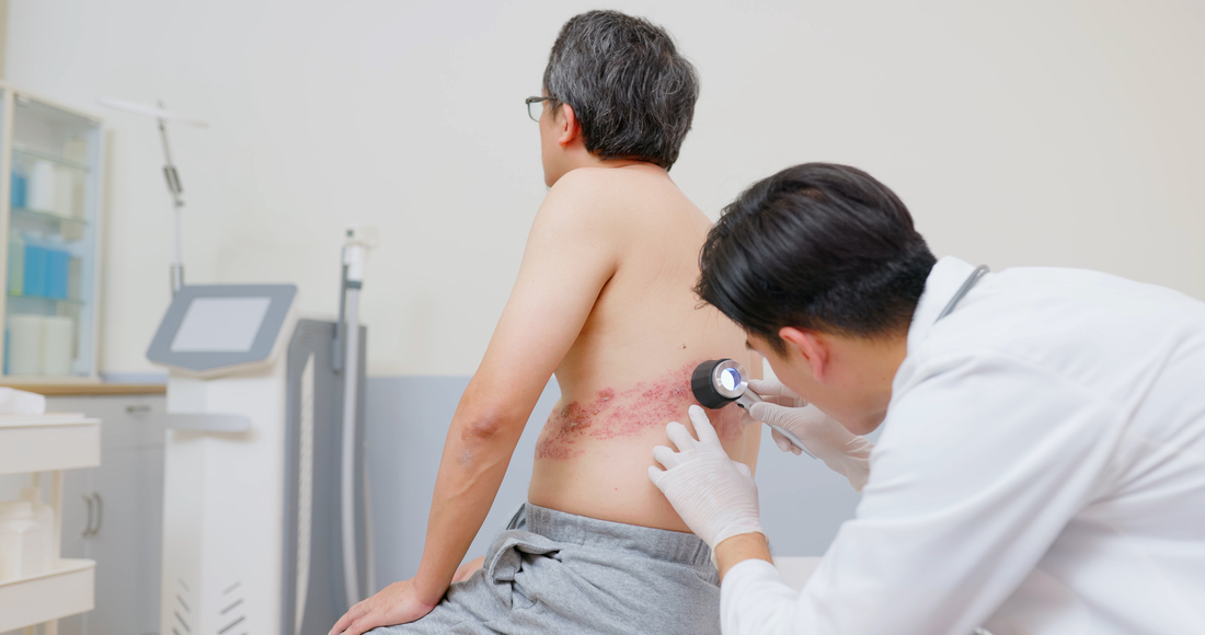 Doctor inspecting man's shingles.jpg
