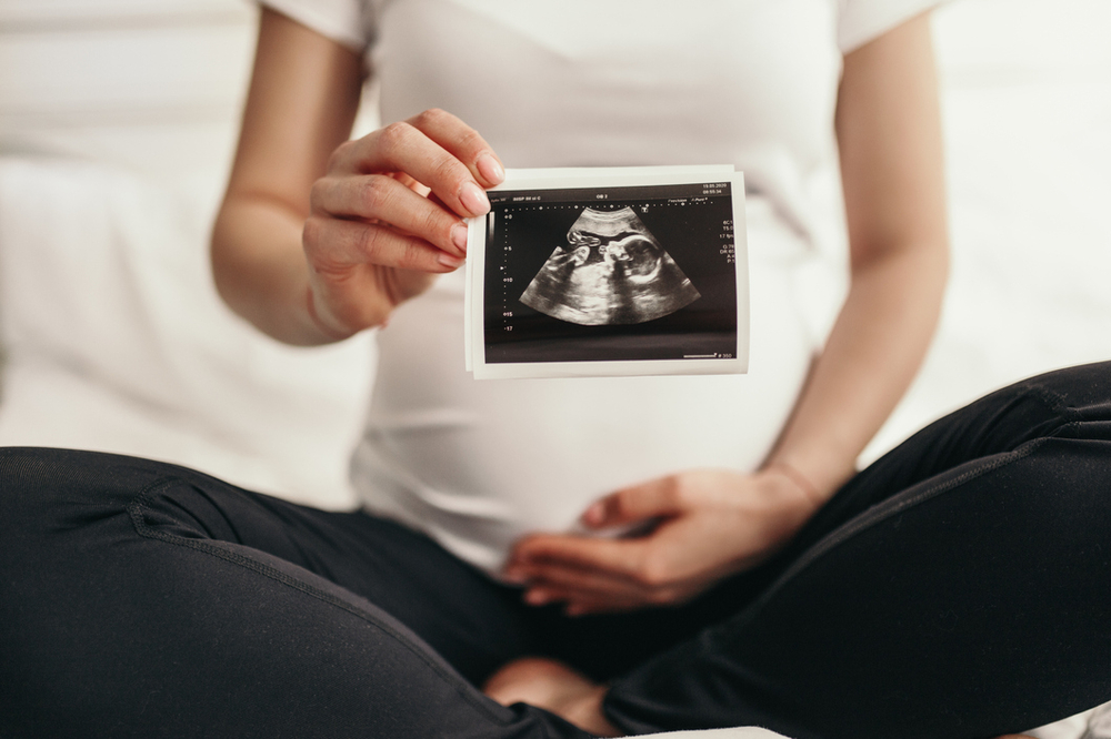 Ultrasound photo second trimester.jpg