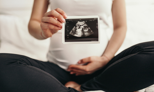 Ultrasound photo second trimester.jpg