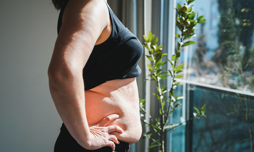 Woman stomach with loose skin.jpg