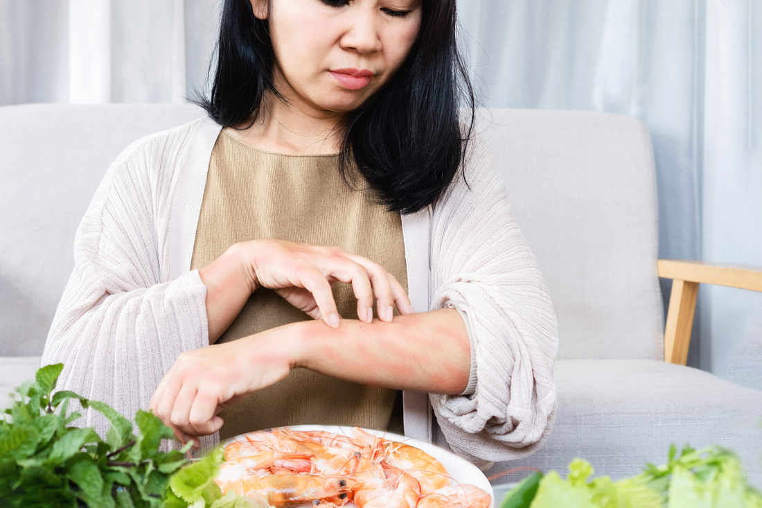 Woman scratching red arms in front of plate of sea food